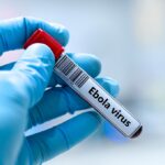Blood,Sample,Tube,For,Ebola,Virus,Test,Analysis.